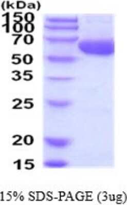 SDS-PAGE: Recombinant Human ACSF2 His Protein [NBP2-52166]