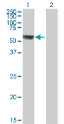 Western Blot: ACSF3 Antibody [H00197322-B01P]