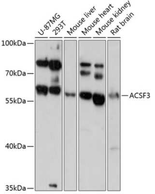 Western Blot: ACSF3 AntibodyAzide and BSA Free [NBP2-92125]