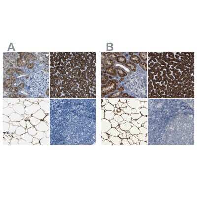 Immunohistochemistry-Paraffin: ACSL1 Antibody [NBP1-89270]