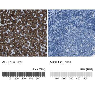 Immunohistochemistry-Paraffin: ACSL1 Antibody [NBP1-89270]