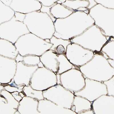 Immunohistochemistry-Paraffin: ACSL1 Antibody [NBP1-89270]