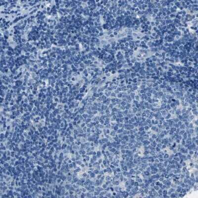 Immunohistochemistry-Paraffin: ACSL1 Antibody [NBP1-89270]