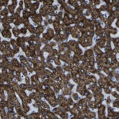 Immunohistochemistry-Paraffin: ACSL1 Antibody [NBP1-89270]