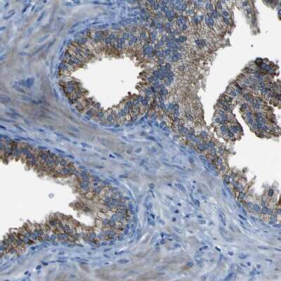 Immunohistochemistry-Paraffin: ACSL1 Antibody [NBP1-89270]