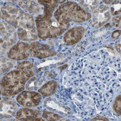 Immunohistochemistry-Paraffin: ACSL1 Antibody [NBP1-89270]