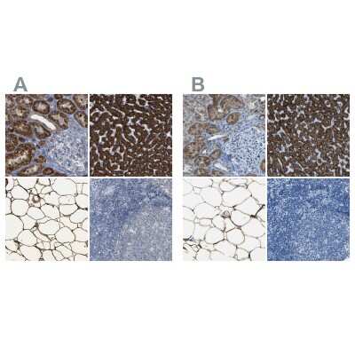 Immunohistochemistry-Paraffin: ACSL1 Antibody [NBP1-89271]