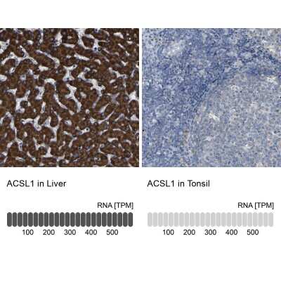 Immunohistochemistry-Paraffin: ACSL1 Antibody [NBP1-89271]