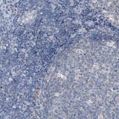 Immunohistochemistry-Paraffin: ACSL1 Antibody [NBP1-89271]