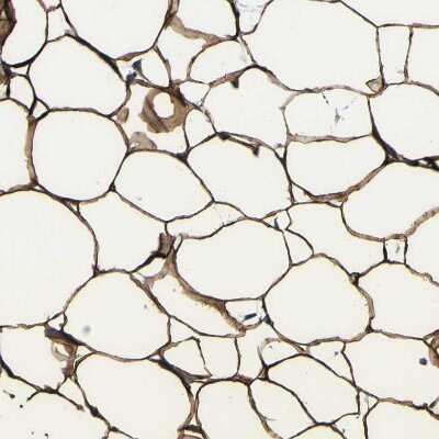 Immunohistochemistry-Paraffin: ACSL1 Antibody [NBP1-89271]