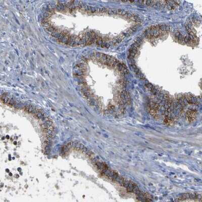 Immunohistochemistry-Paraffin: ACSL1 Antibody [NBP1-89271]