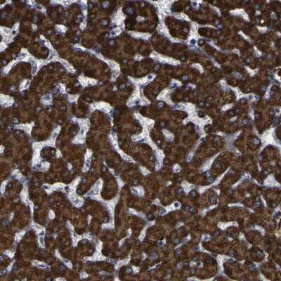 Immunohistochemistry-Paraffin: ACSL1 Antibody [NBP1-89271]