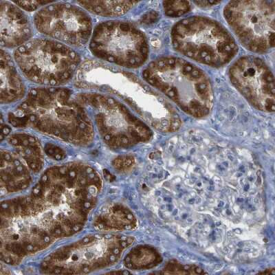 Immunohistochemistry-Paraffin: ACSL1 Antibody [NBP1-89271]