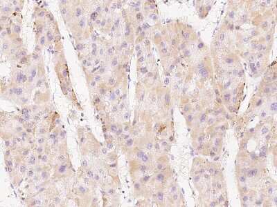 Immunohistochemistry-Paraffin: ACSL1 Antibody [NBP2-99339]