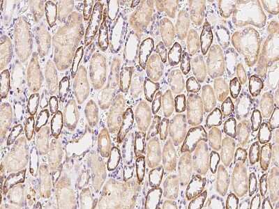 Immunohistochemistry-Paraffin: ACSL1 Antibody [NBP2-99339]