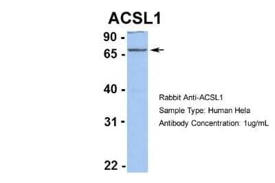 Western Blot: ACSL1 Antibody [NBP1-60016]