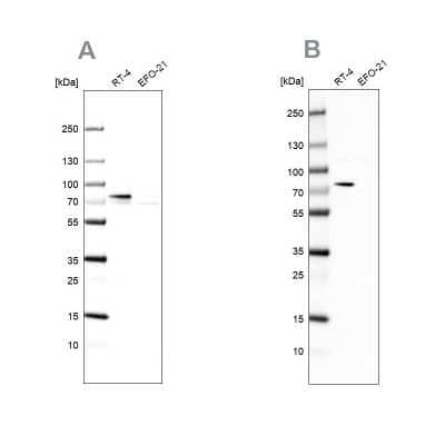 Western Blot: ACSL1 Antibody [NBP1-89270]