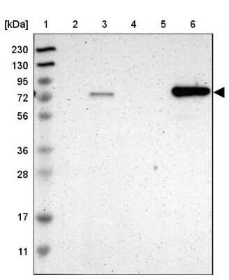 Western Blot: ACSL1 Antibody [NBP1-89271]