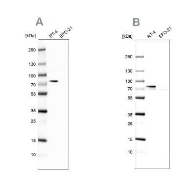 Western Blot: ACSL1 Antibody [NBP1-89271]