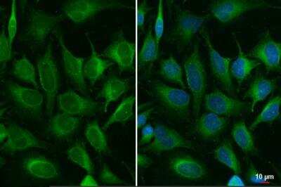 Immunocytochemistry/ Immunofluorescence: ACSL3 Antibody [NBP2-15252]