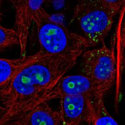 Immunocytochemistry/ Immunofluorescence: ACSL3 Antibody [NBP2-58817]