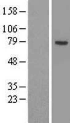 Western Blot: ACSL3 Overexpression Lysate [NBL1-07263]