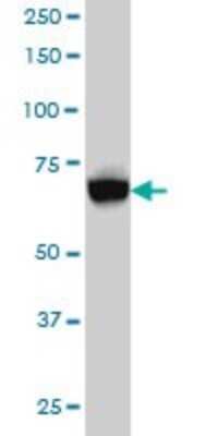 Western Blot: ACSL5 Antibody (5H8) [H00051703-M01]