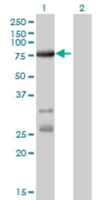 Western Blot: ACSL5 Antibody (5H8) [H00051703-M01]