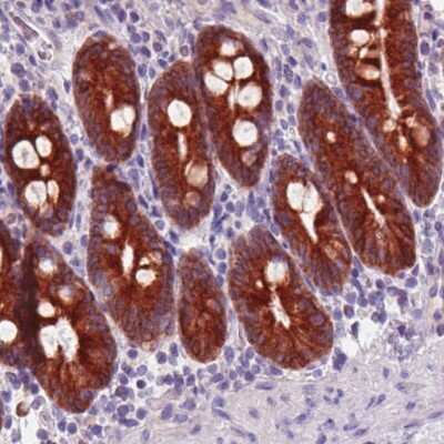 Immunohistochemistry: ACSL5 Antibody (CL0275) [NBP2-52899]