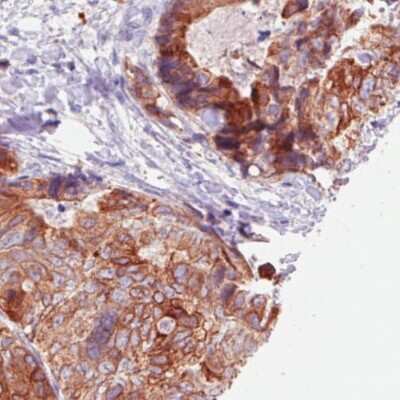Immunohistochemistry-Paraffin: ACSL5 Antibody (CL0275) [NBP2-52899]