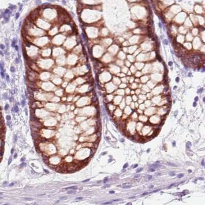Immunohistochemistry-Paraffin: ACSL5 Antibody (CL0275) [NBP2-52899]