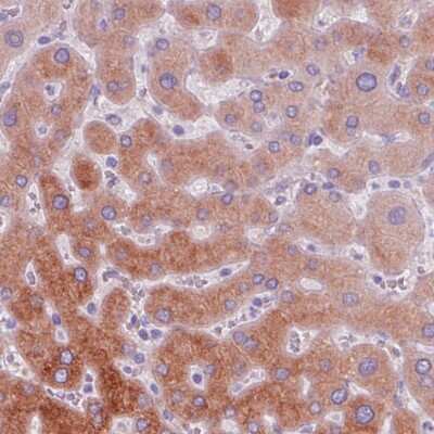 Immunohistochemistry-Paraffin: ACSL5 Antibody (CL0275) [NBP2-52899]