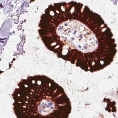 Immunohistochemistry-Paraffin: ACSL5 Antibody (CL0275) [NBP2-52899]