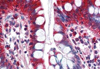Immunohistochemistry-Paraffin: ACSL5 Antibody [NB100-2918]