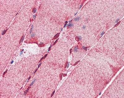 Immunohistochemistry-Paraffin: ACSL5 Antibody [NBP1-59645]