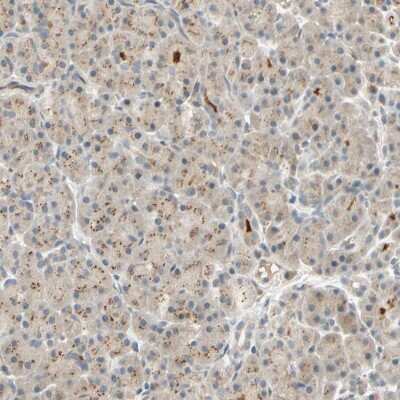 Immunohistochemistry-Paraffin: ACSL5 Antibody [NBP2-31995]