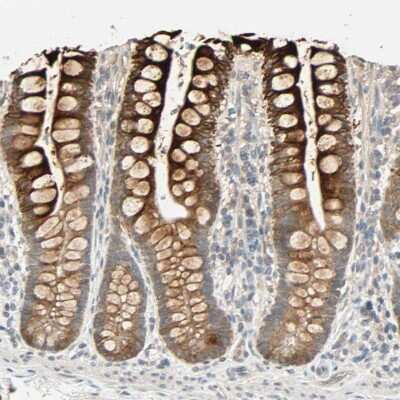 Immunohistochemistry-Paraffin: ACSL5 Antibody [NBP2-31995]