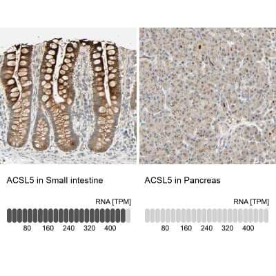 Immunohistochemistry-Paraffin: ACSL5 Antibody [NBP2-31995]