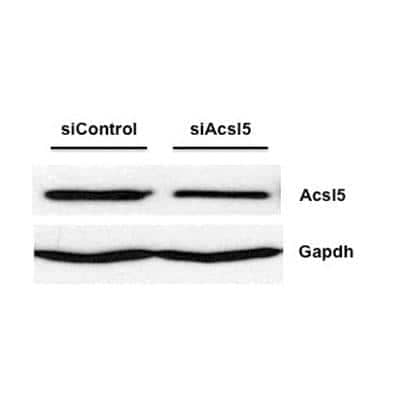 Western Blot: ACSL5 Antibody [NBP1-59645]