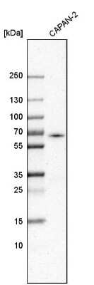 Western Blot: ACSL5 Antibody [NBP2-31995]