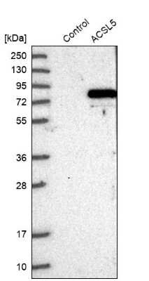 Western Blot: ACSL5 Antibody [NBP2-31995]