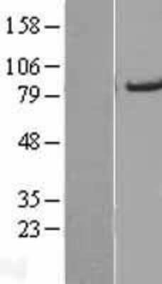 Western Blot: ACSL5 Overexpression Lysate [NBL1-07266]