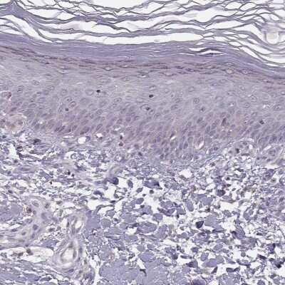 Immunohistochemistry-Paraffin: ACSL6 Antibody [NBP1-89269]