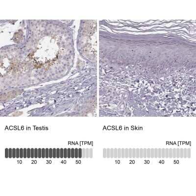 Immunohistochemistry-Paraffin: ACSL6 Antibody [NBP1-89269]