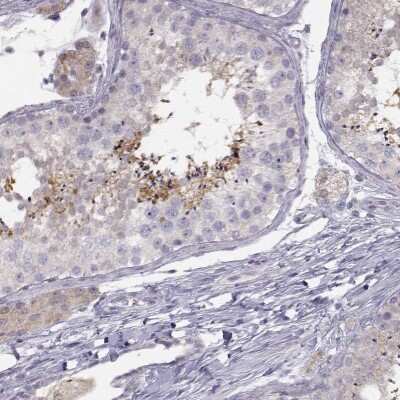 Immunohistochemistry-Paraffin: ACSL6 Antibody [NBP1-89269]