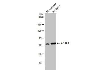 Western Blot: ACSL6 Antibody [NBP2-15253]