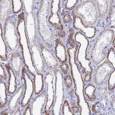 Immunohistochemistry-Paraffin: ACSM1 Antibody [NBP1-91645]