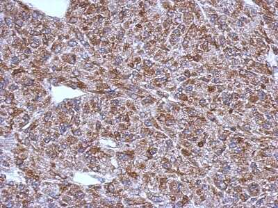 Immunohistochemistry-Paraffin: ACSM1 Antibody [NBP2-15254]