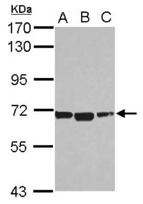 Western Blot: ACSM1 Antibody [NBP2-15254]