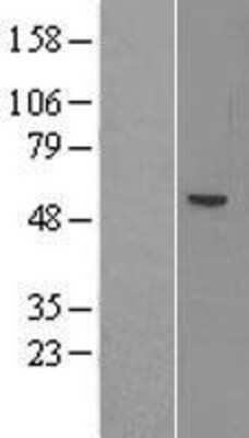 Western Blot: ACSM1 Overexpression Lysate [NBL1-07267]